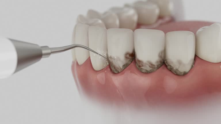 Trusted Teeth Whitening service in Daingerfield, TX - Dentist Open Now